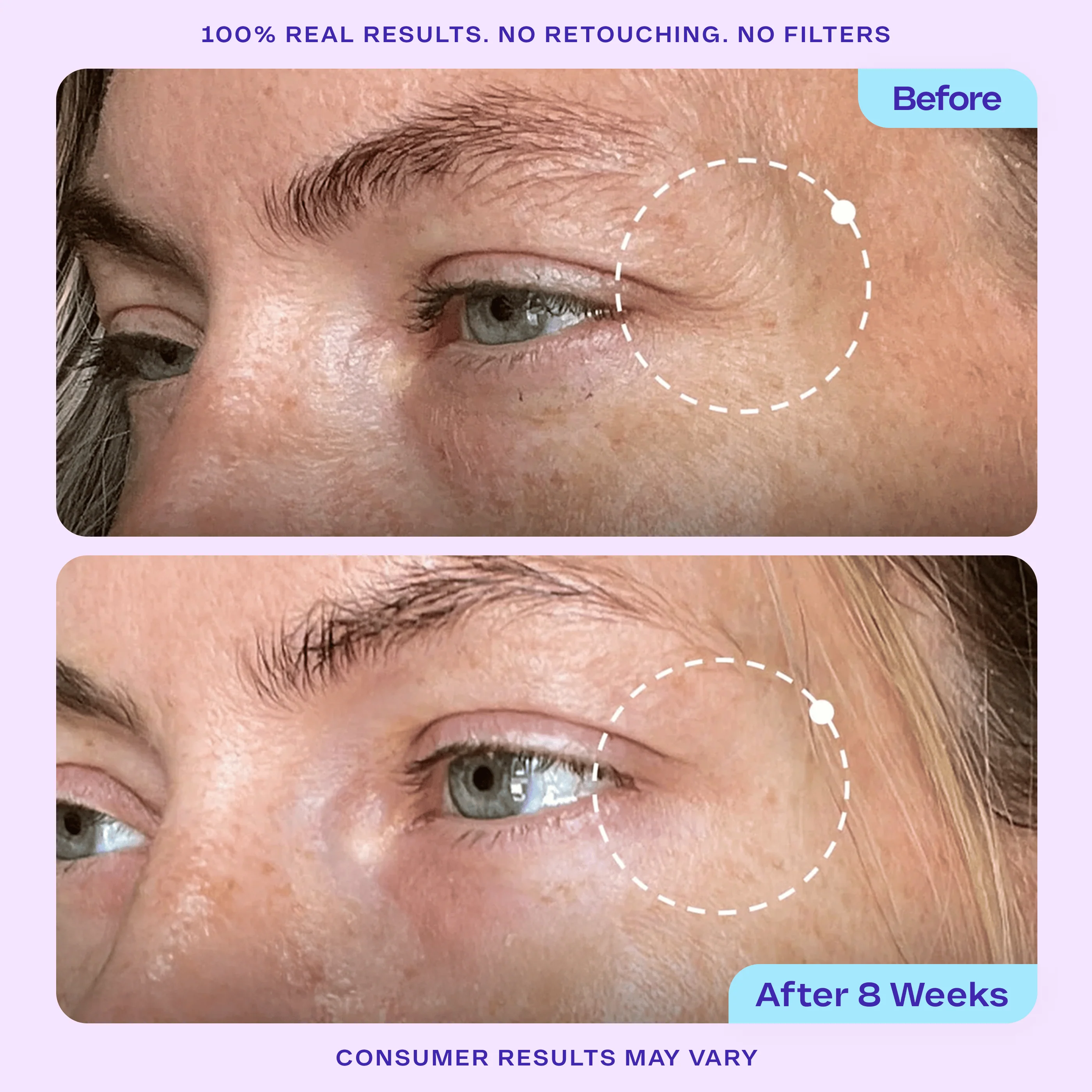 Advanced Repair Eye Cream - Image 5