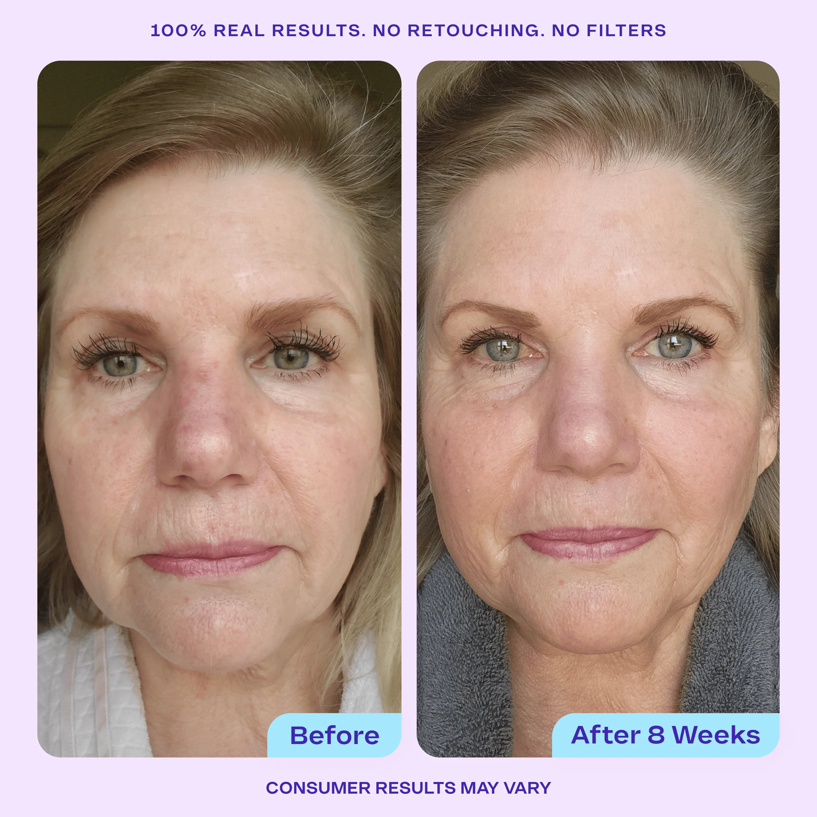 Anti Wrinkle Moisturizer - Image 3