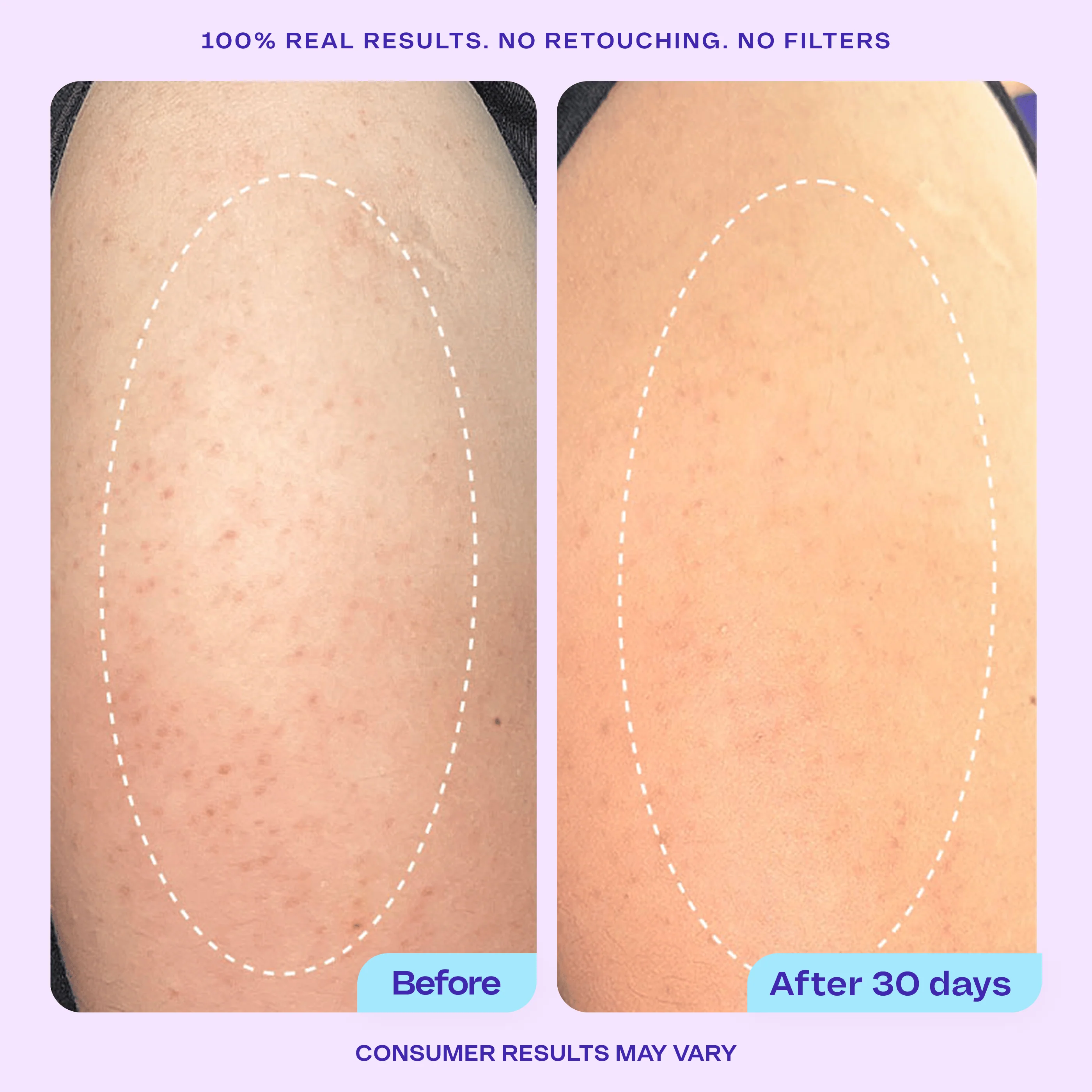 Butt & Thigh Firming Duo - Image 8