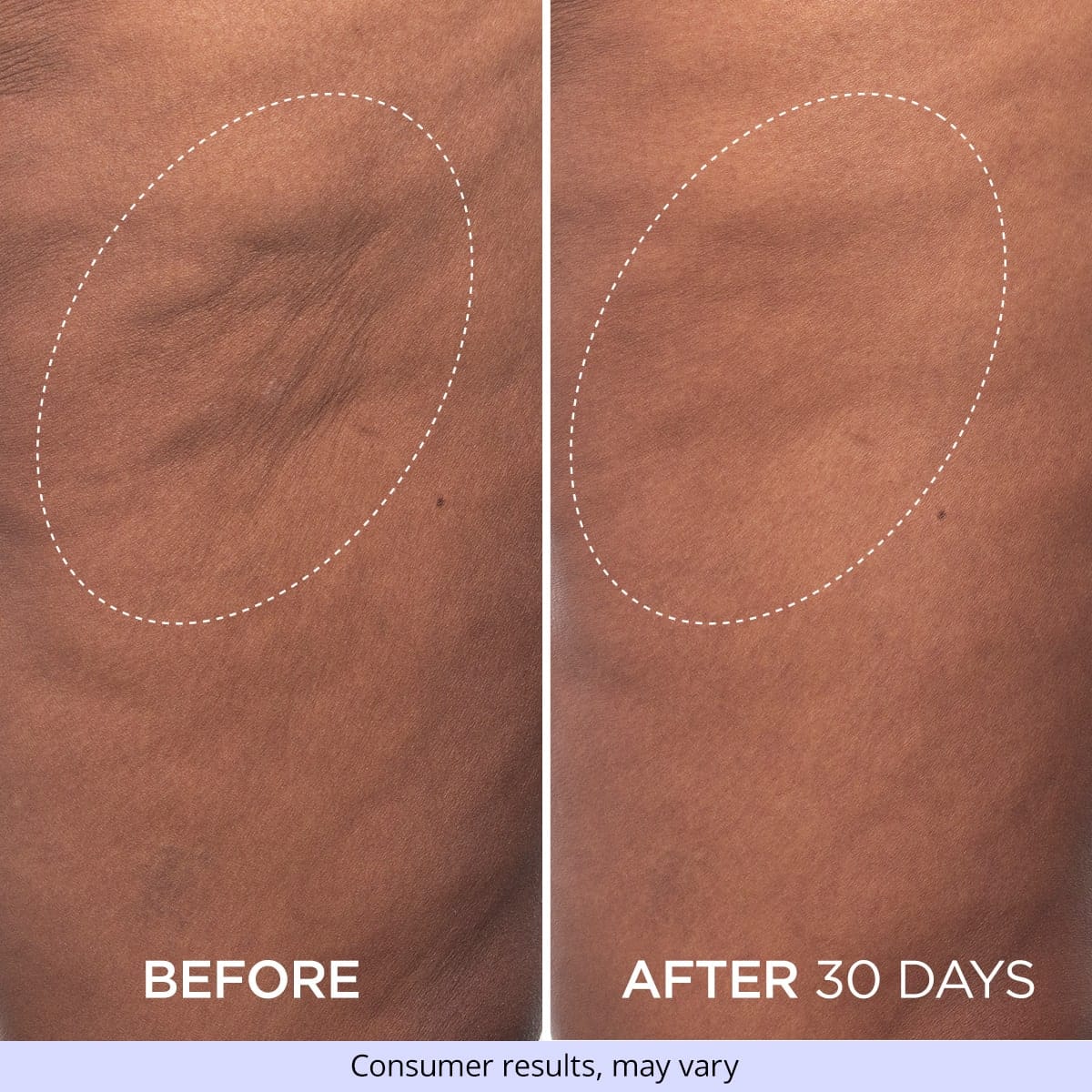 Firming Butt & Thigh Cream - Limited Offer - Image 3