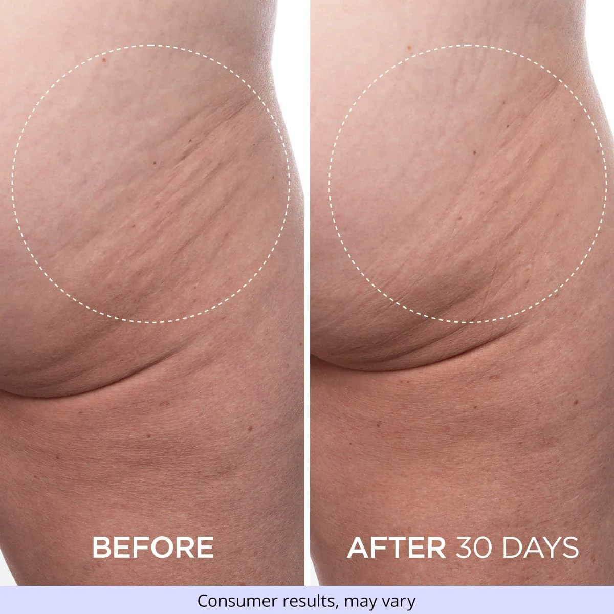 Firming Butt & Thigh Cream - Limited Offer - Image 8