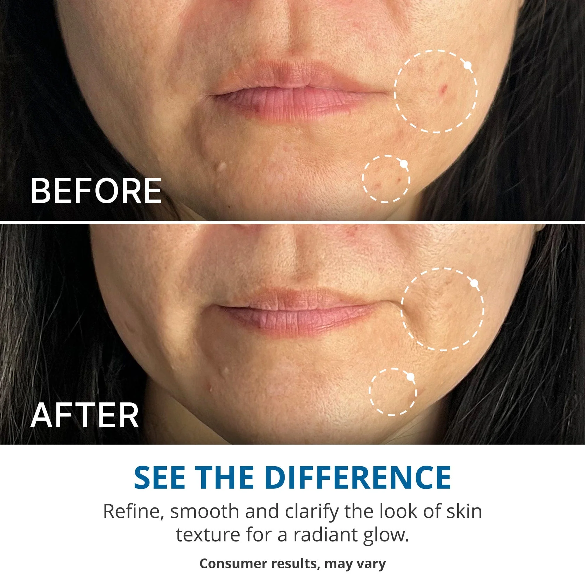 Instant Facial Exfoliation Set - Image 3