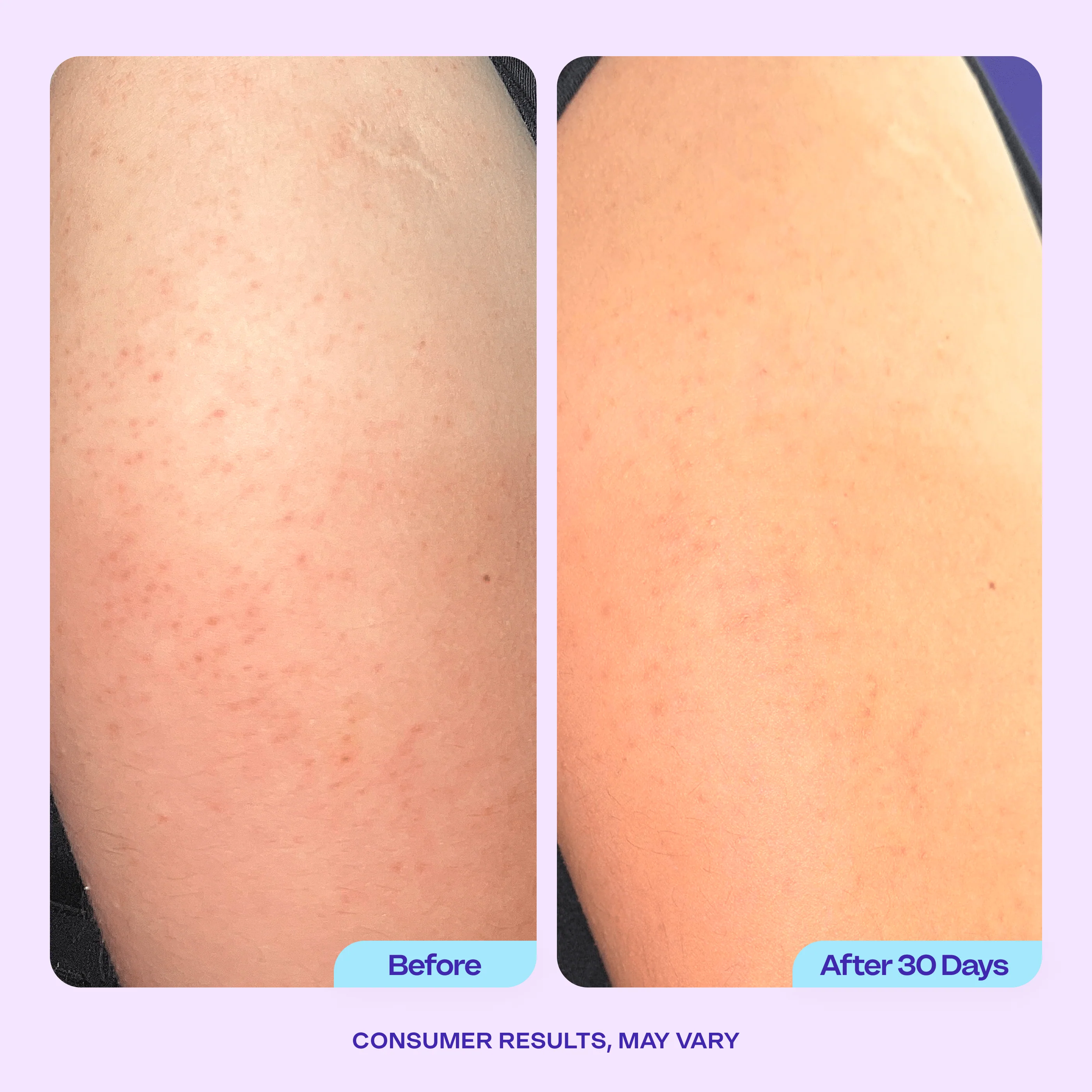 Refine & Renew Body Scrub - Image 3