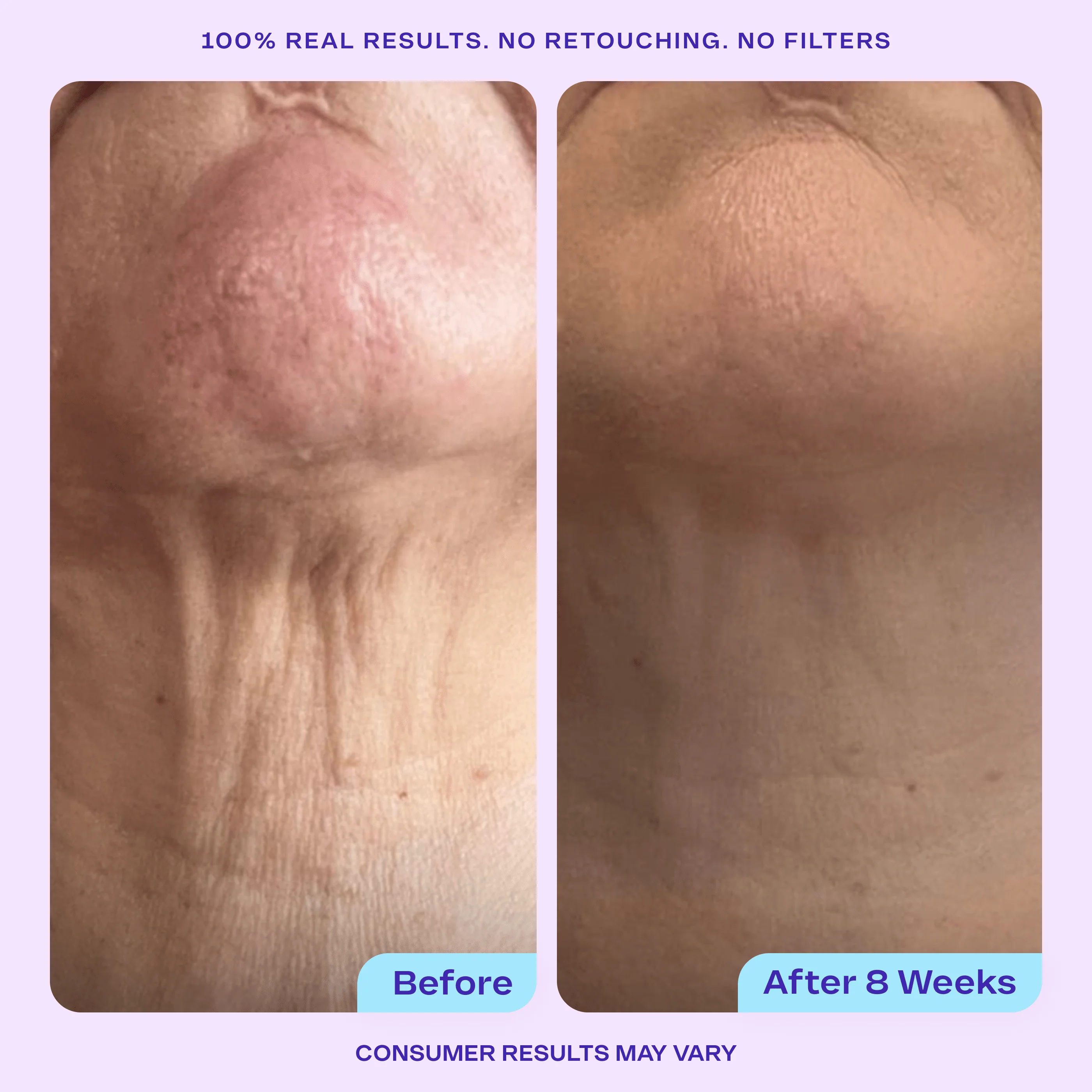 Sculpt & Lift Duo - Image 4