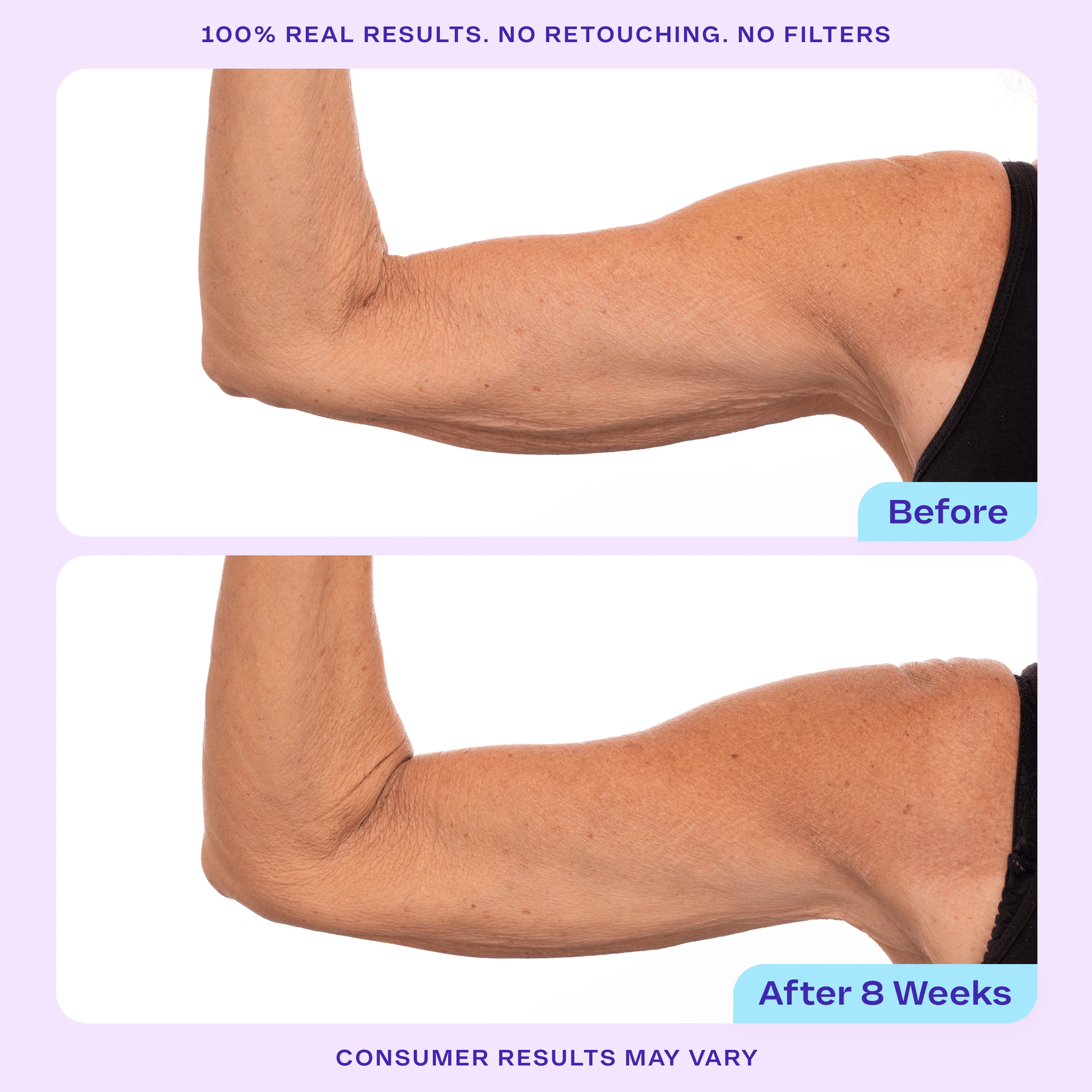 Sculpt & Lift Duo - Image 7