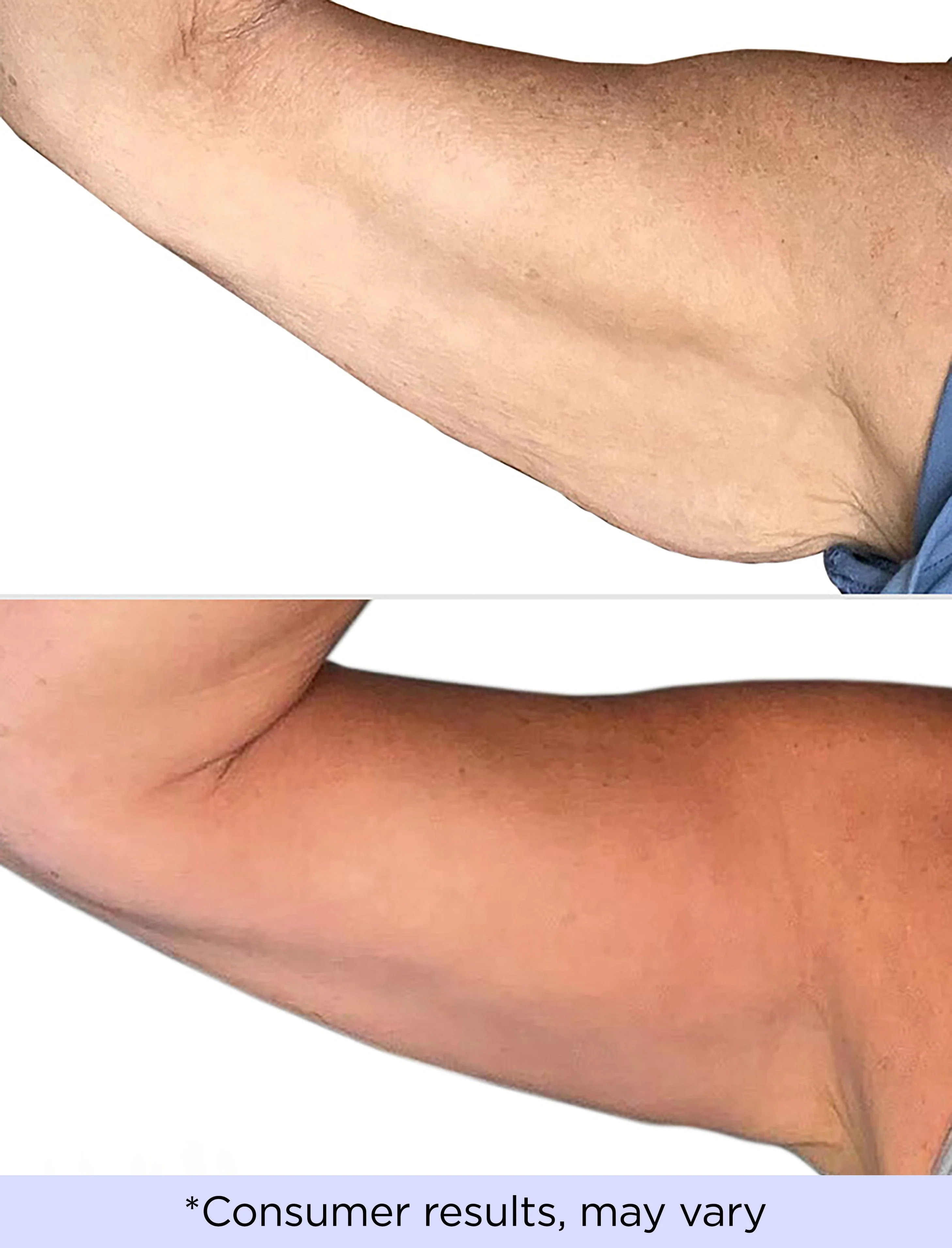 Sculpt & Lift Duo - Image 5