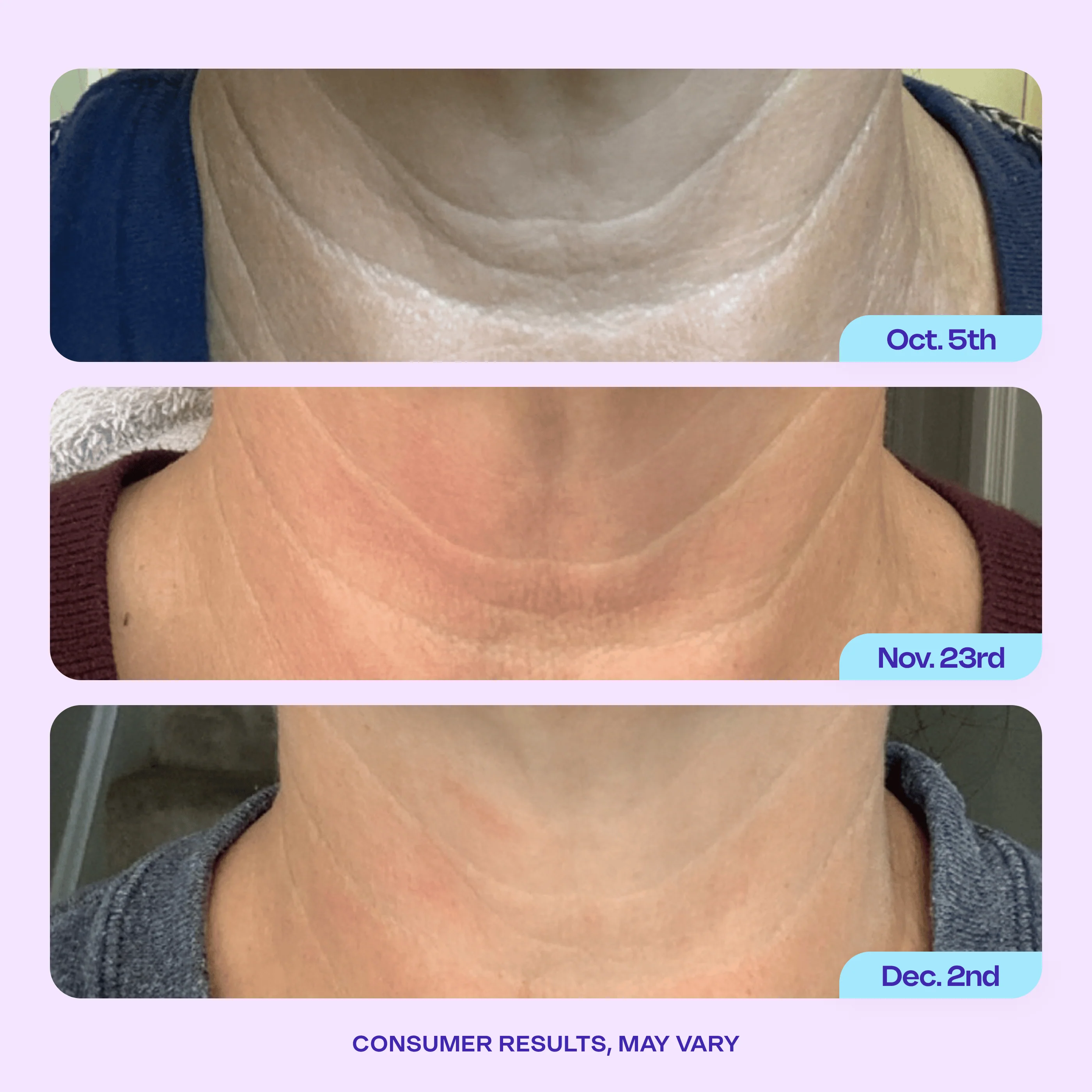 Tighten & Lift Neck Cream - Image 3
