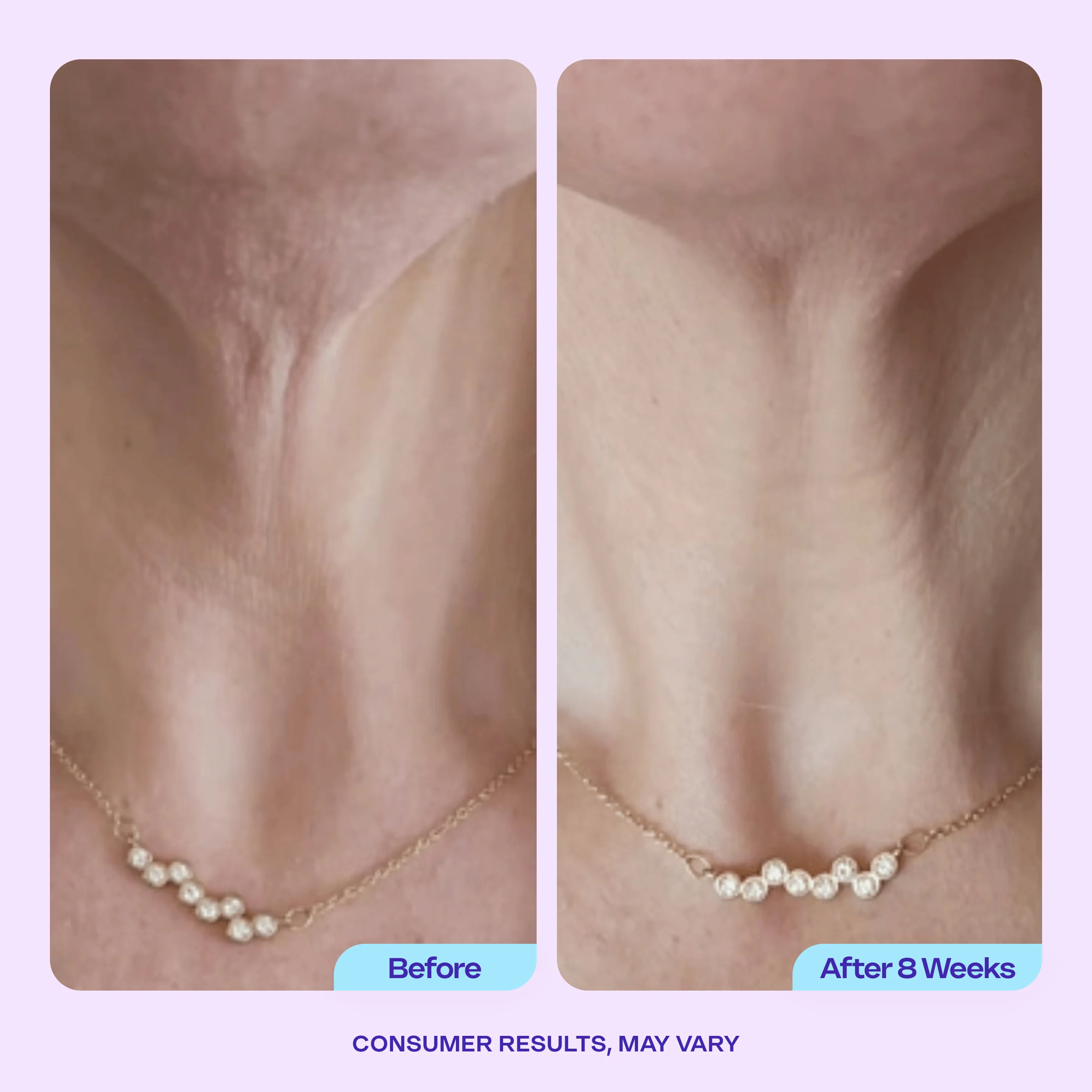 Tighten & Lift Neck Cream - Image 6
