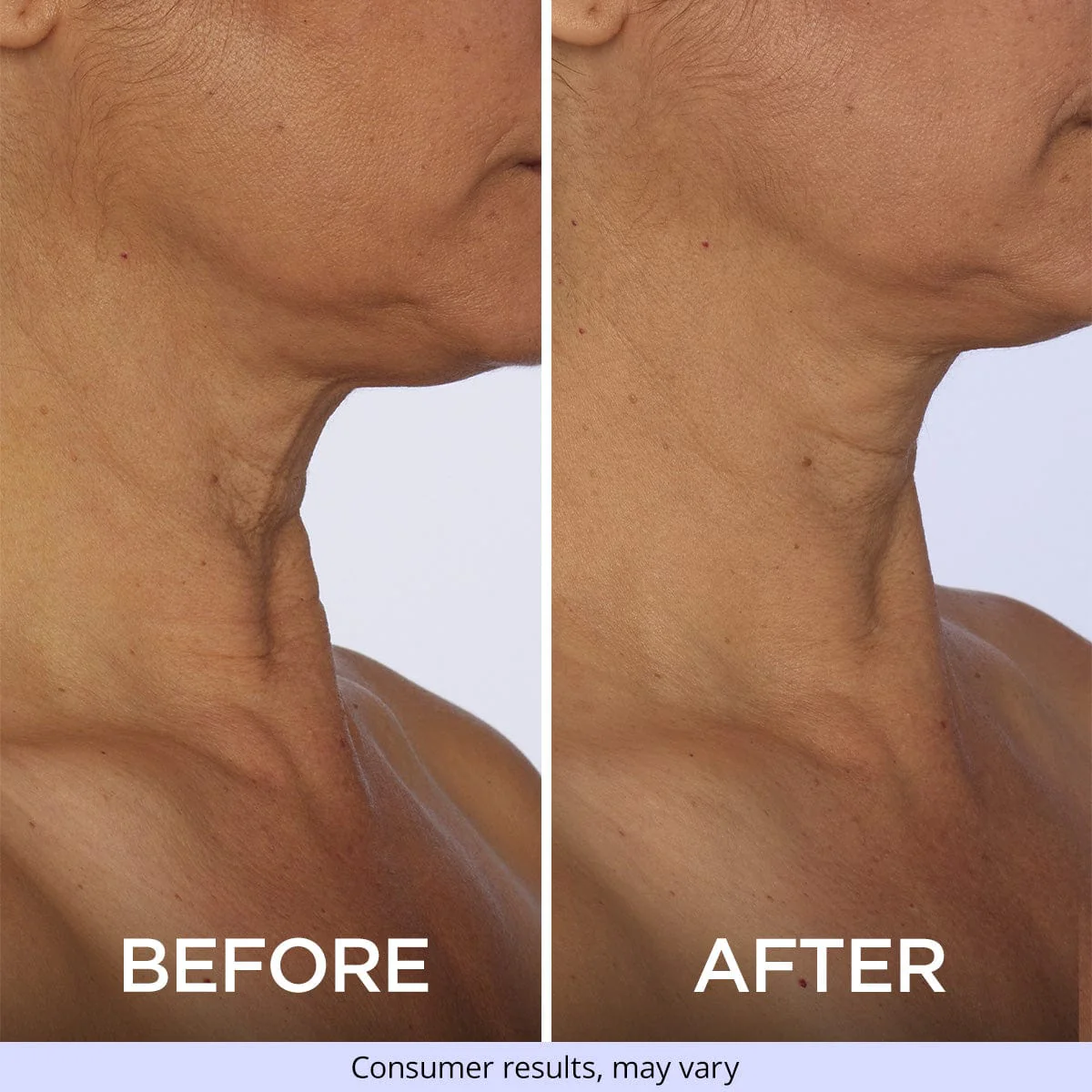 Tighten & Lift Neck Cream - Image 8