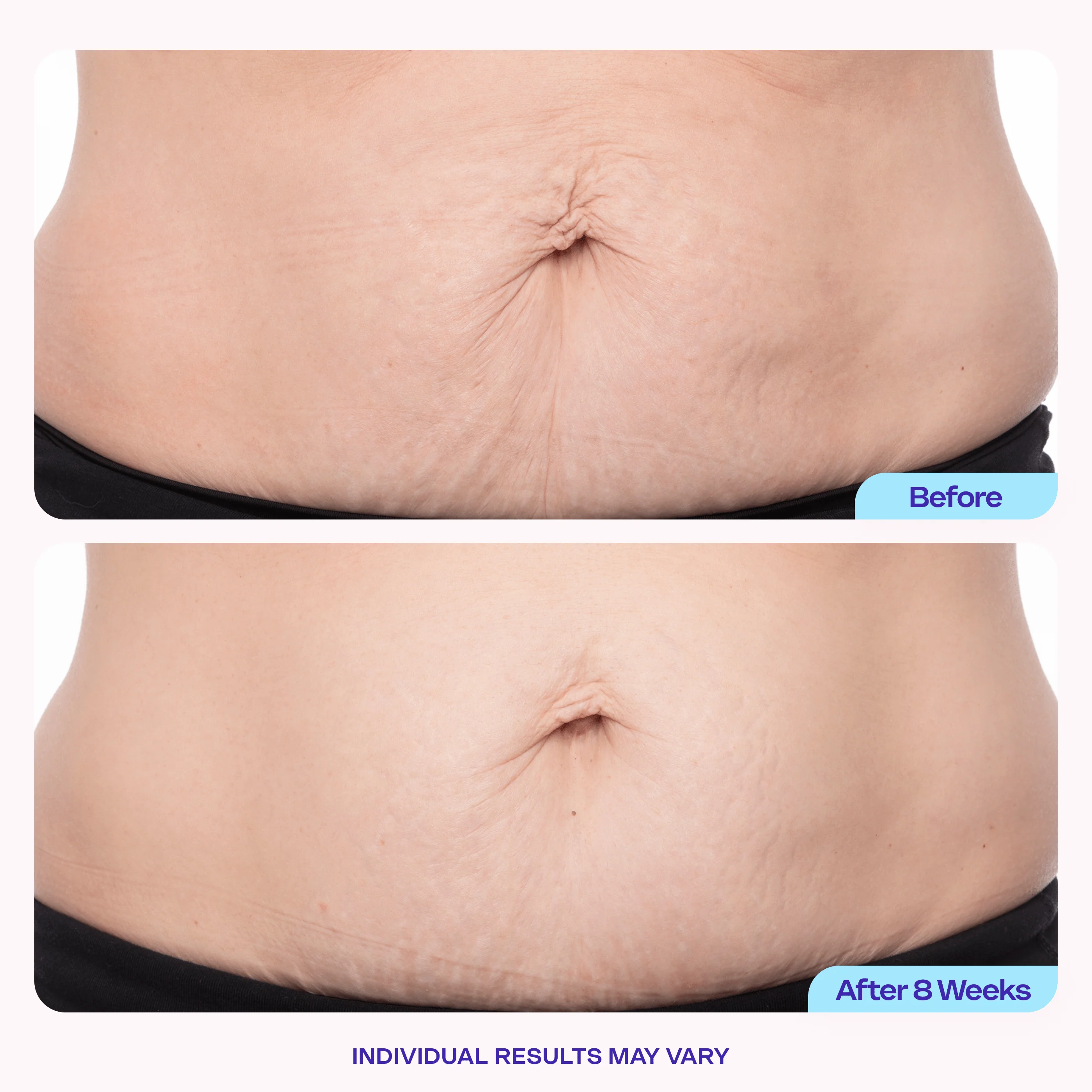 Tighten & Smooth Belly Cream - Image 3