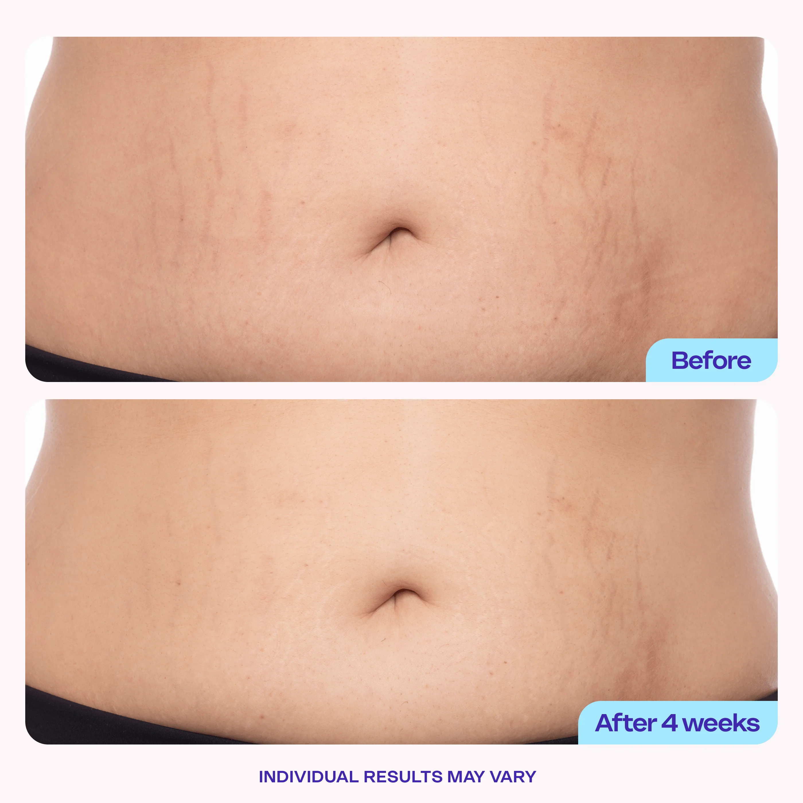 Tighten & Smooth Belly Cream - Image 6