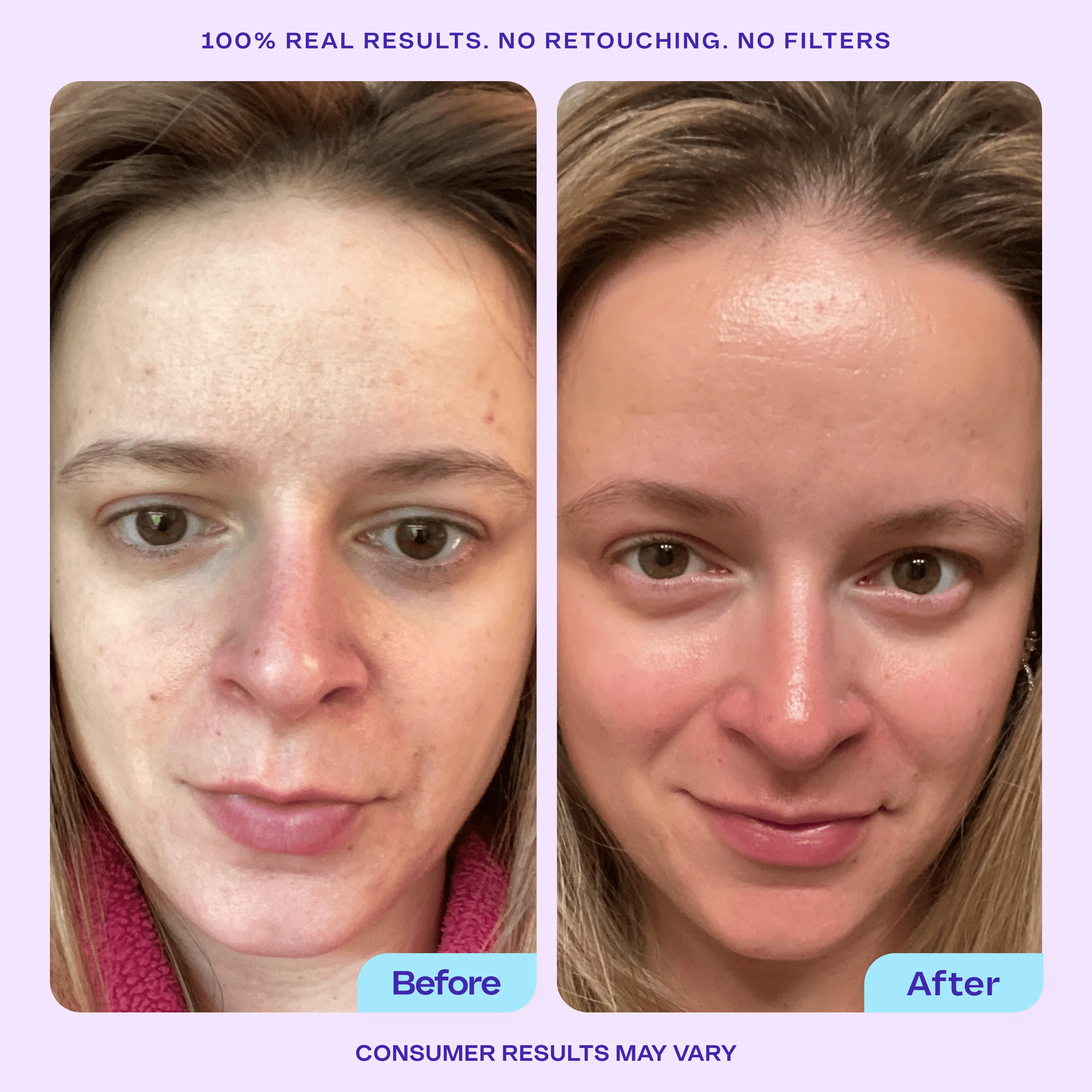 Niacinamide Booster Serum - Image 3