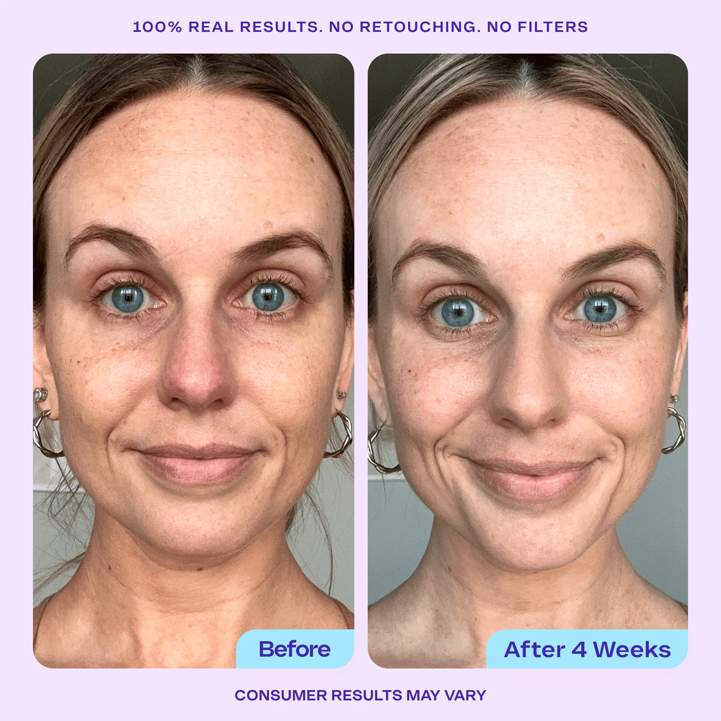 Wake Up Radiant AHA Peel - Image 3