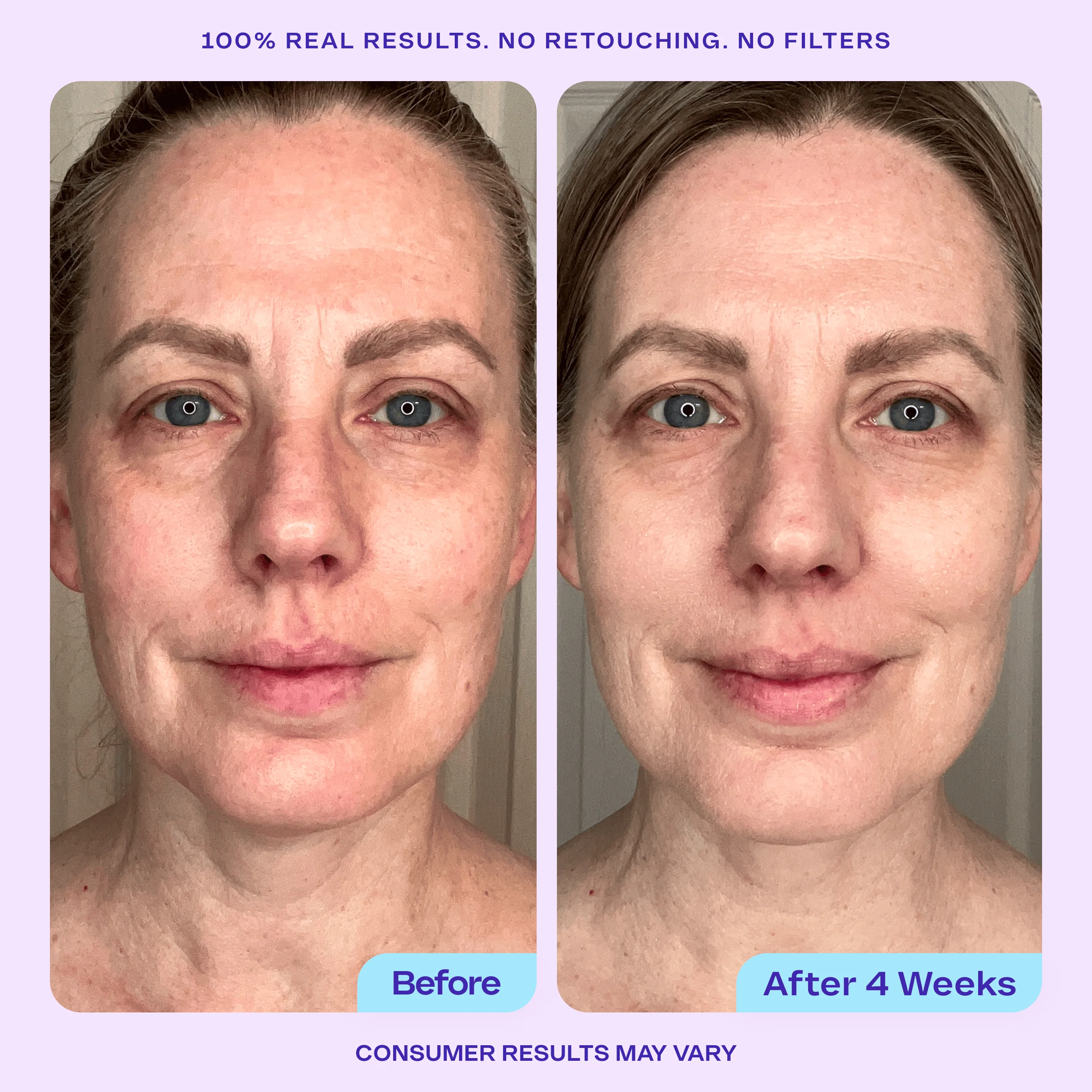 Wake Up Radiant AHA Peel - Image 5