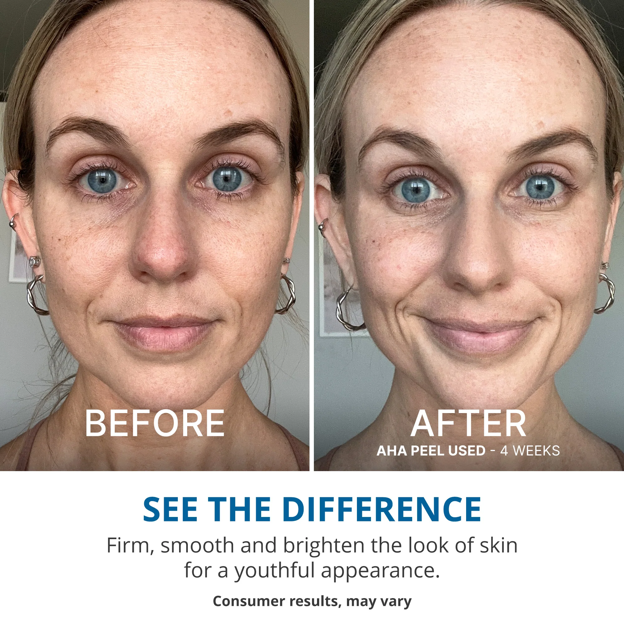 Wake Up Radiant AHA Peel - Image 3