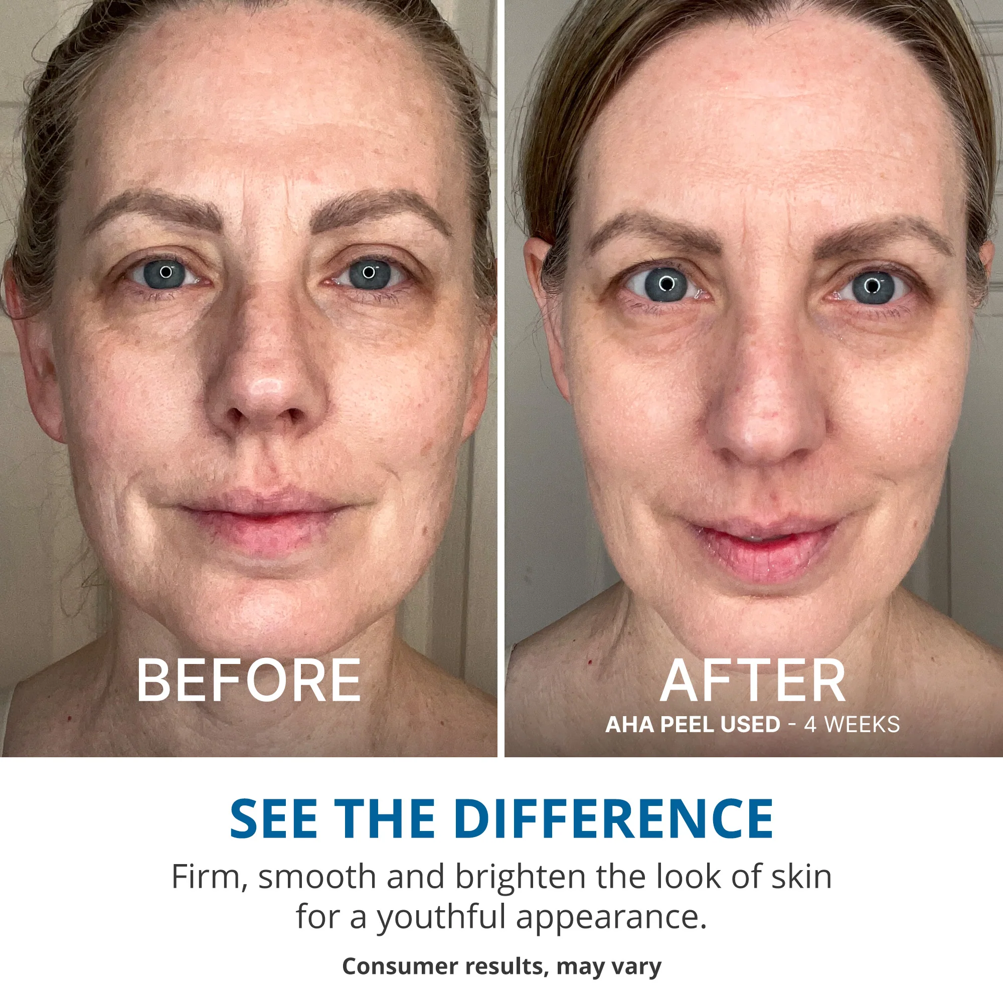 Wake Up Radiant AHA Peel - Image 4